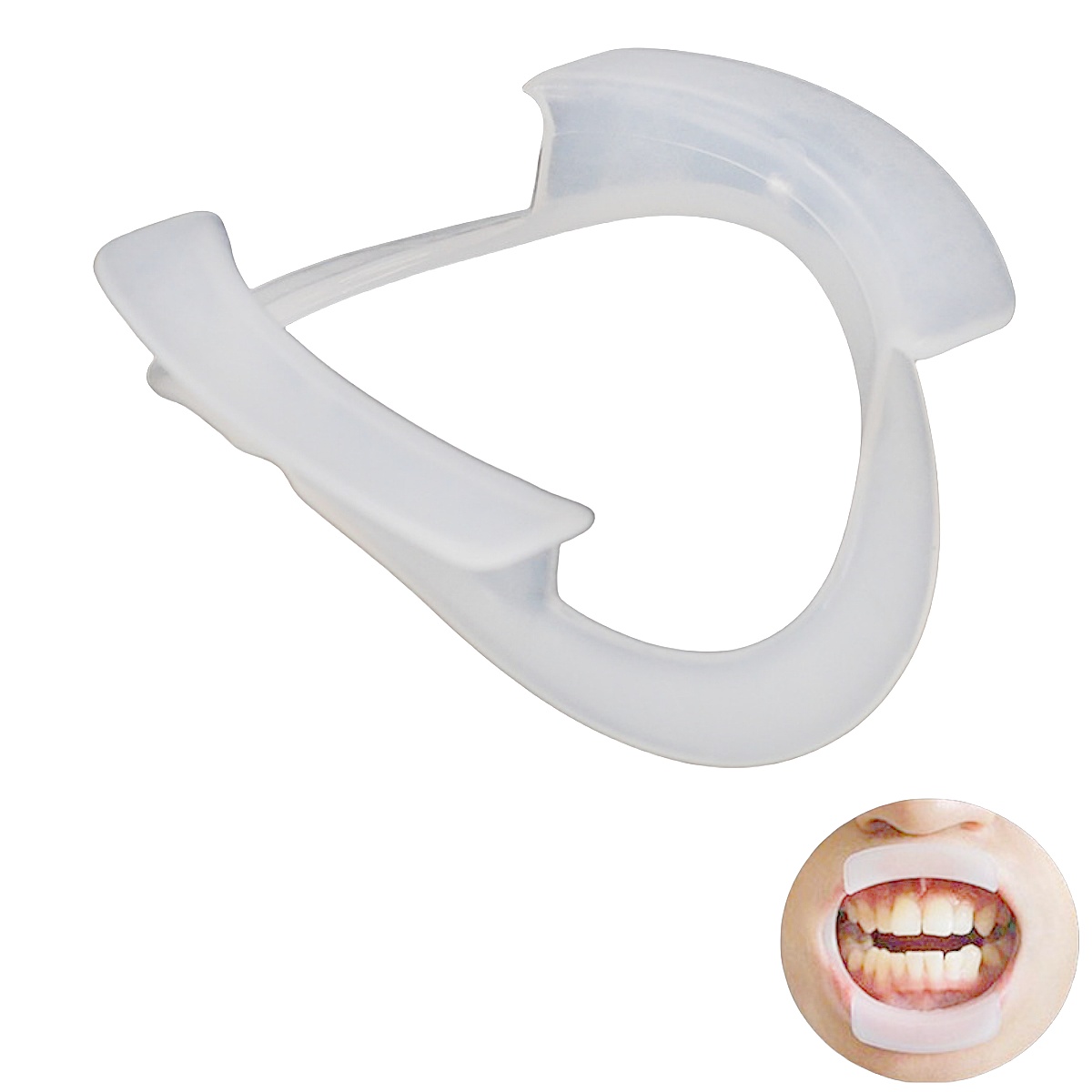 Teeth Whitening With Braces - 100 pièces/sac Écarteurs buccaux intra-oraux en