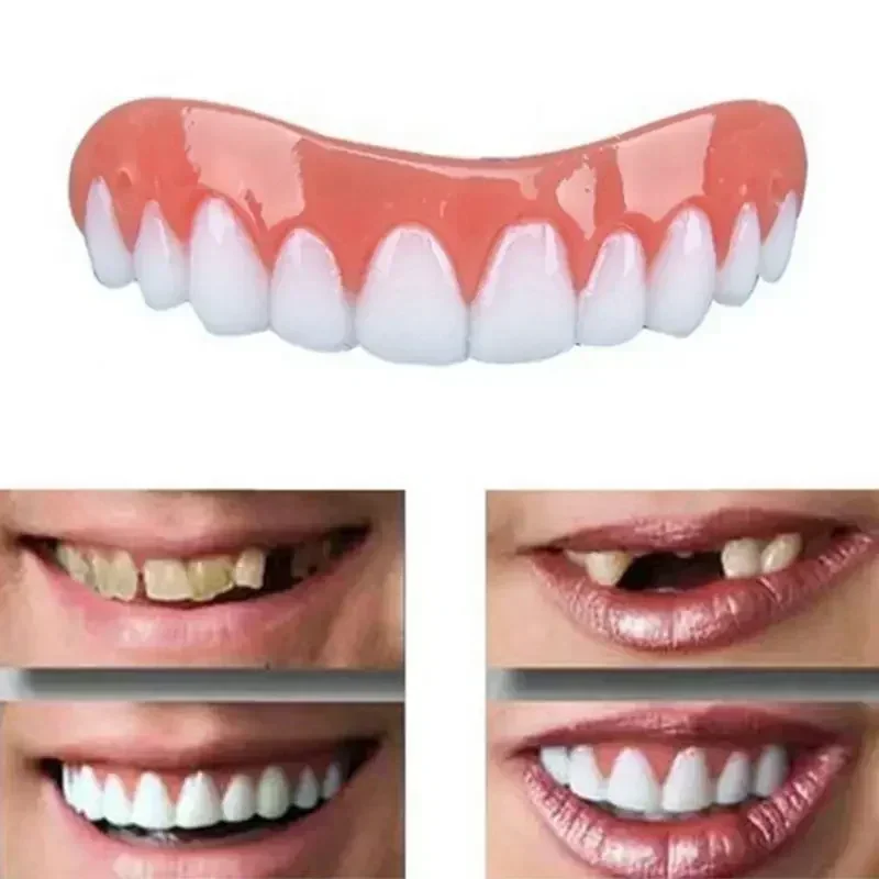 Teeth Whitening With Braces - Nouvelles fausses dents en silicone, placages