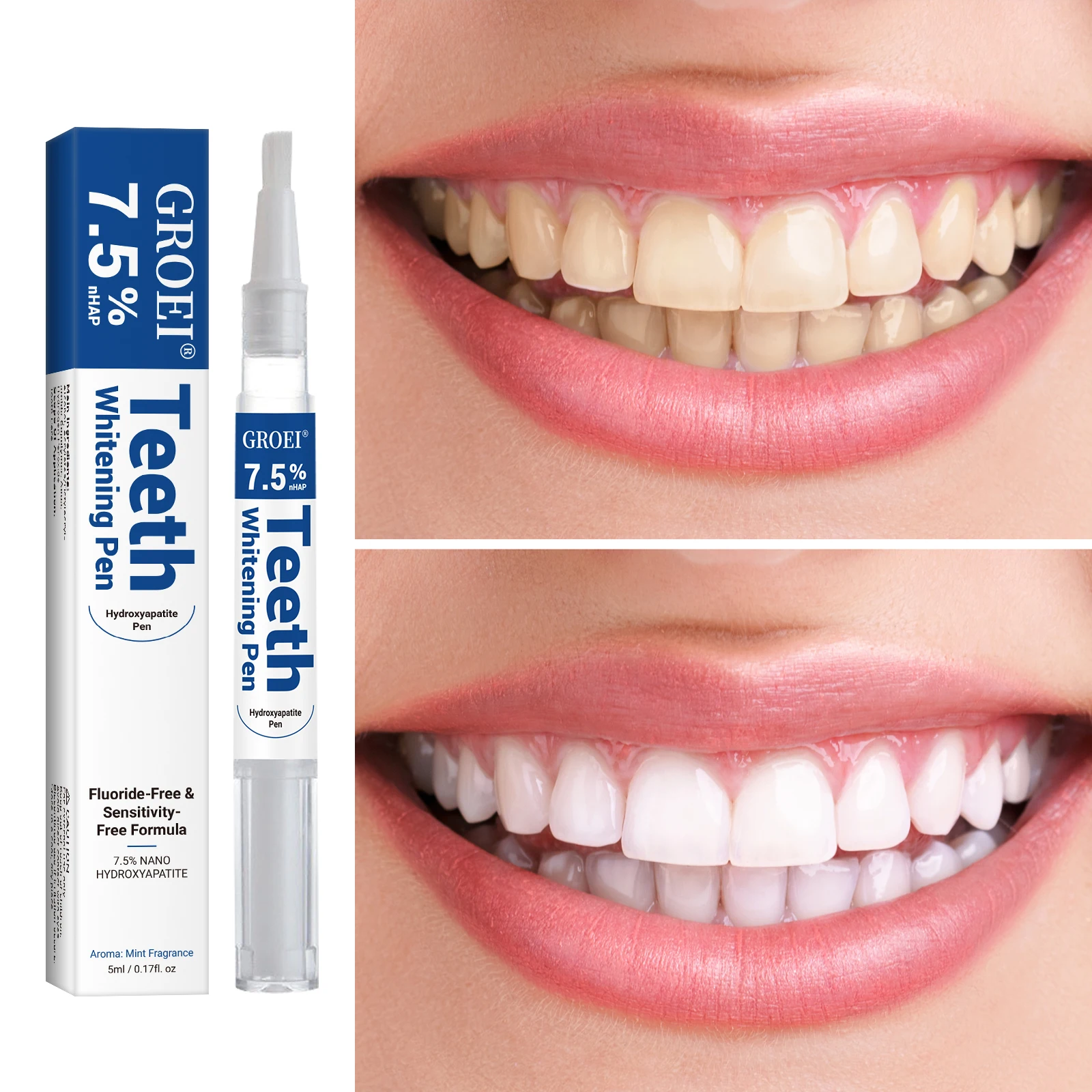 Stylo de blanchiment des dents - Teeth Whitening With Peroxide avis et prix