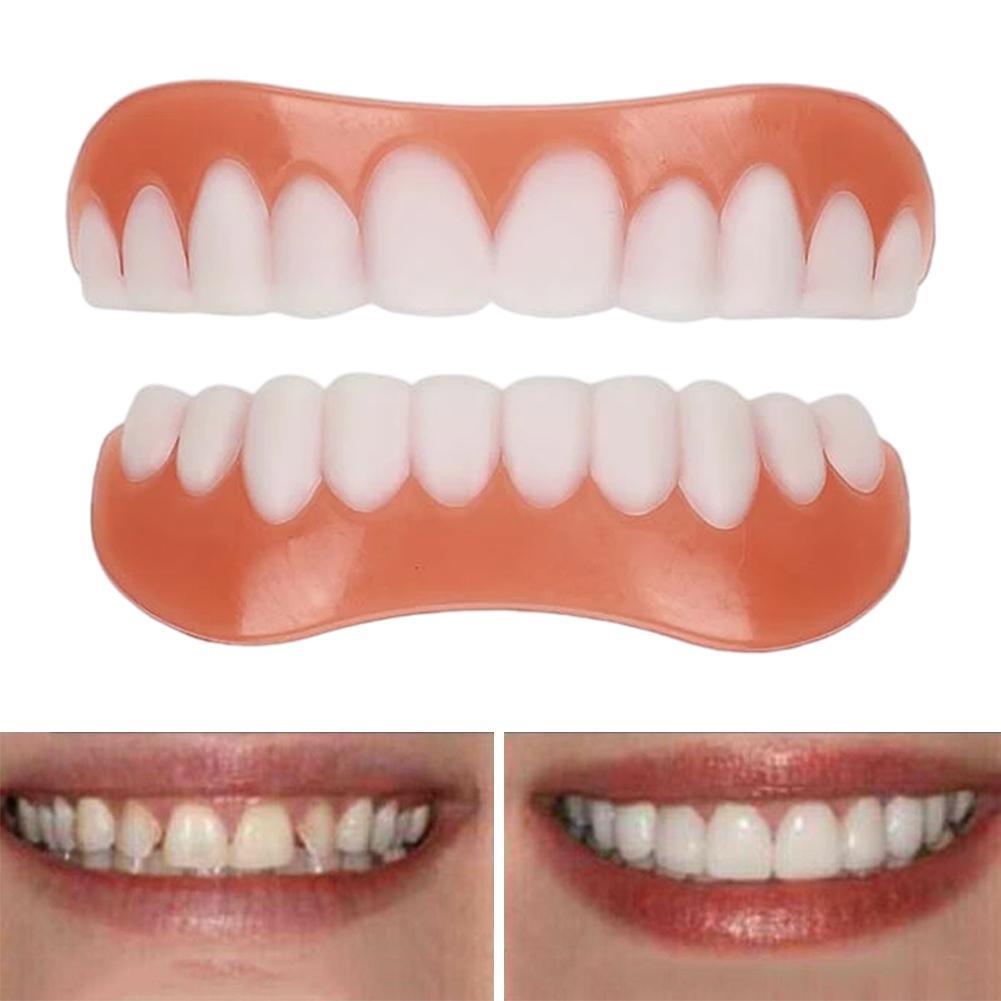 Nouvelles fausses dents en sil - Teeth Whitening With Braces avis et prix