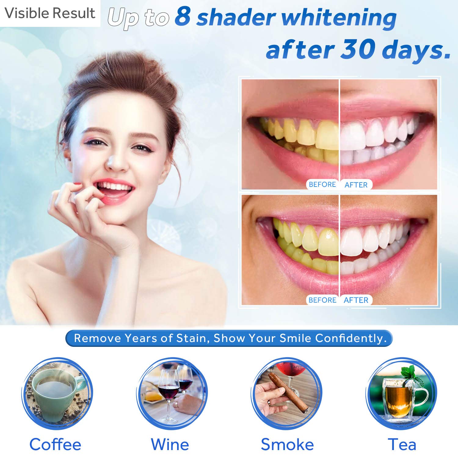 Gel de blanchiment des dents r - Teeth Whitening With Peroxide avis et prix