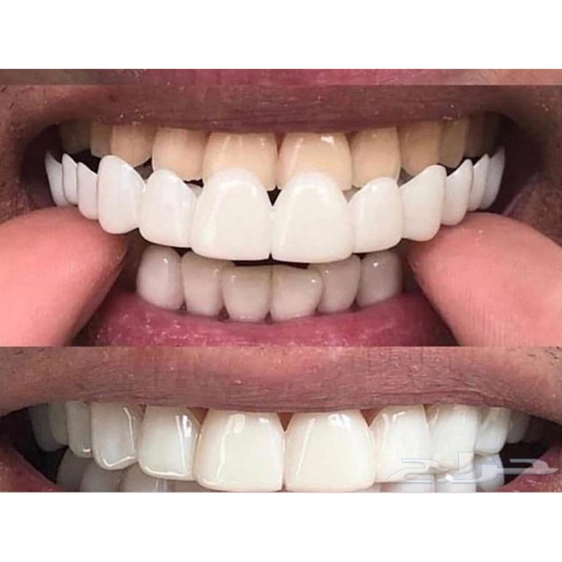 Gel de Silicone souple dentair - Teeth Whitening Moulds avis et prix