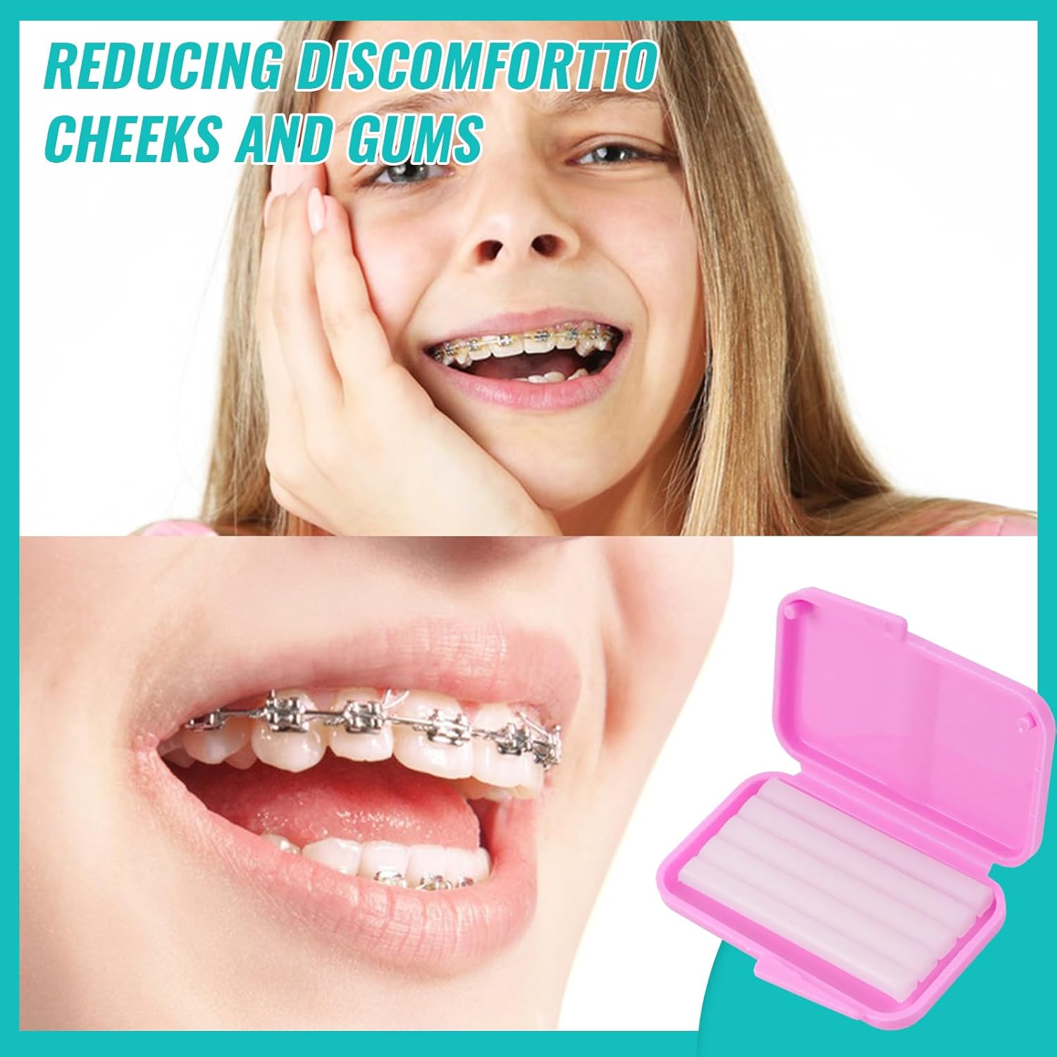 10 boîtes de cire de soulageme - Teeth Whitening With Braces avis et prix