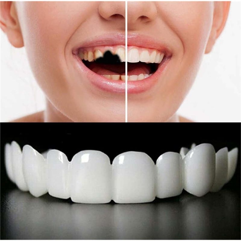 [NOUVEAU! ABMK] 2 paires, redo - Teeth Whitening With Braces avis et prix