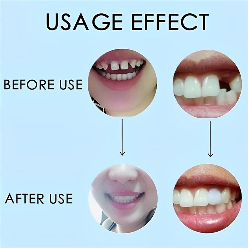 [NOUVEAU! ABMK] 2 paires, redo - Teeth Whitening With Braces avis et prix